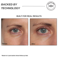 Sensilift Smart RF Skin-Firming