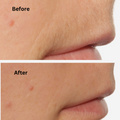 Before and After